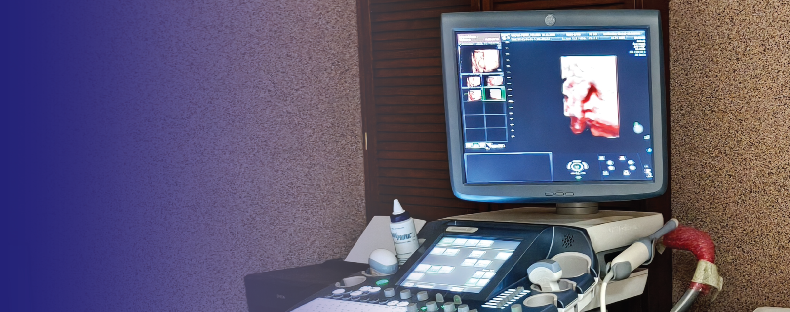 Brindamos atención ginecológica y obstétrica de primer nivel